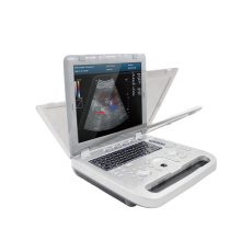 Contec Handheld Human Color Doppler Sistema de diagnóstico ultrassônico Máquina de ultrassom digital CMS1700A
